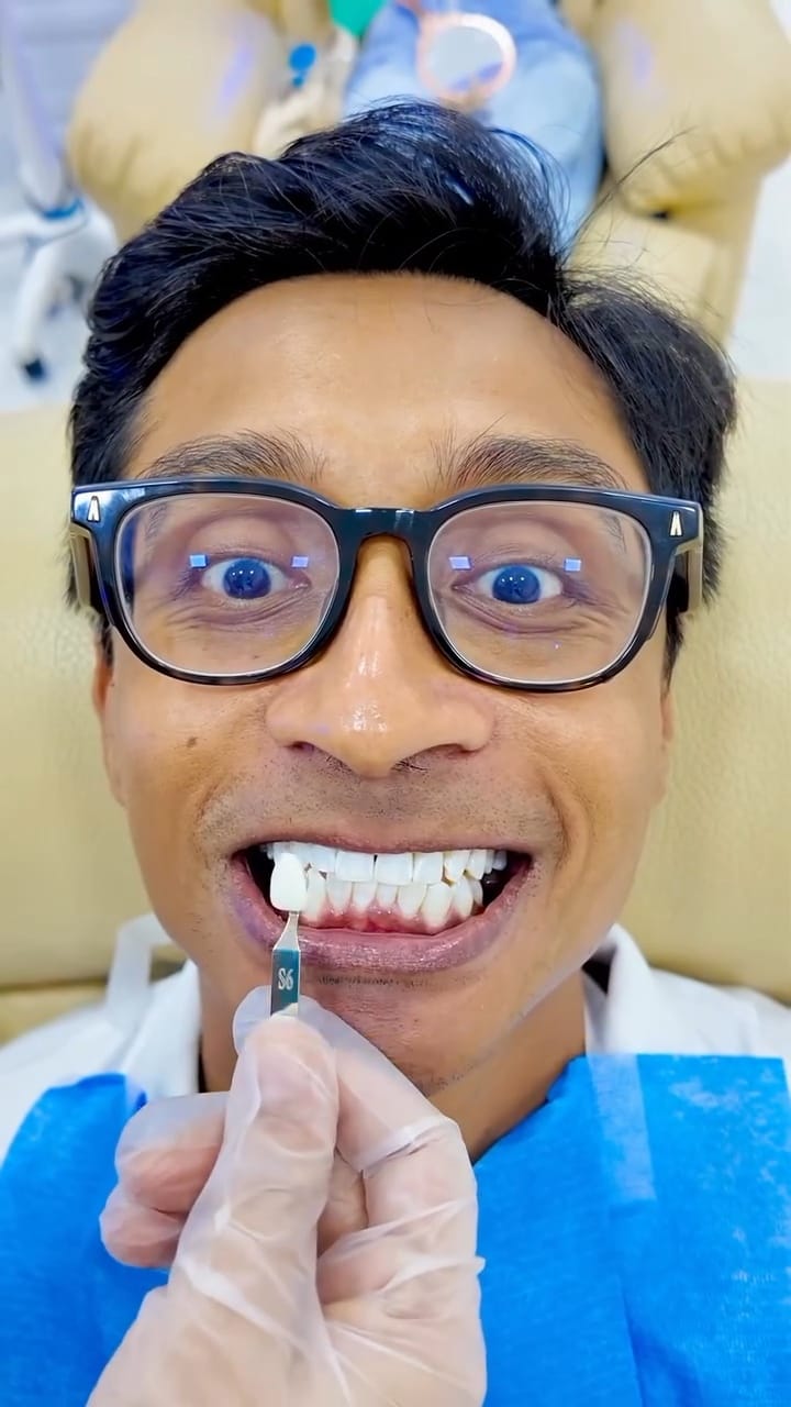 護理後:即刻擁有更燦爛的笑容! 護理後:即刻擁有更燦爛的笑容!