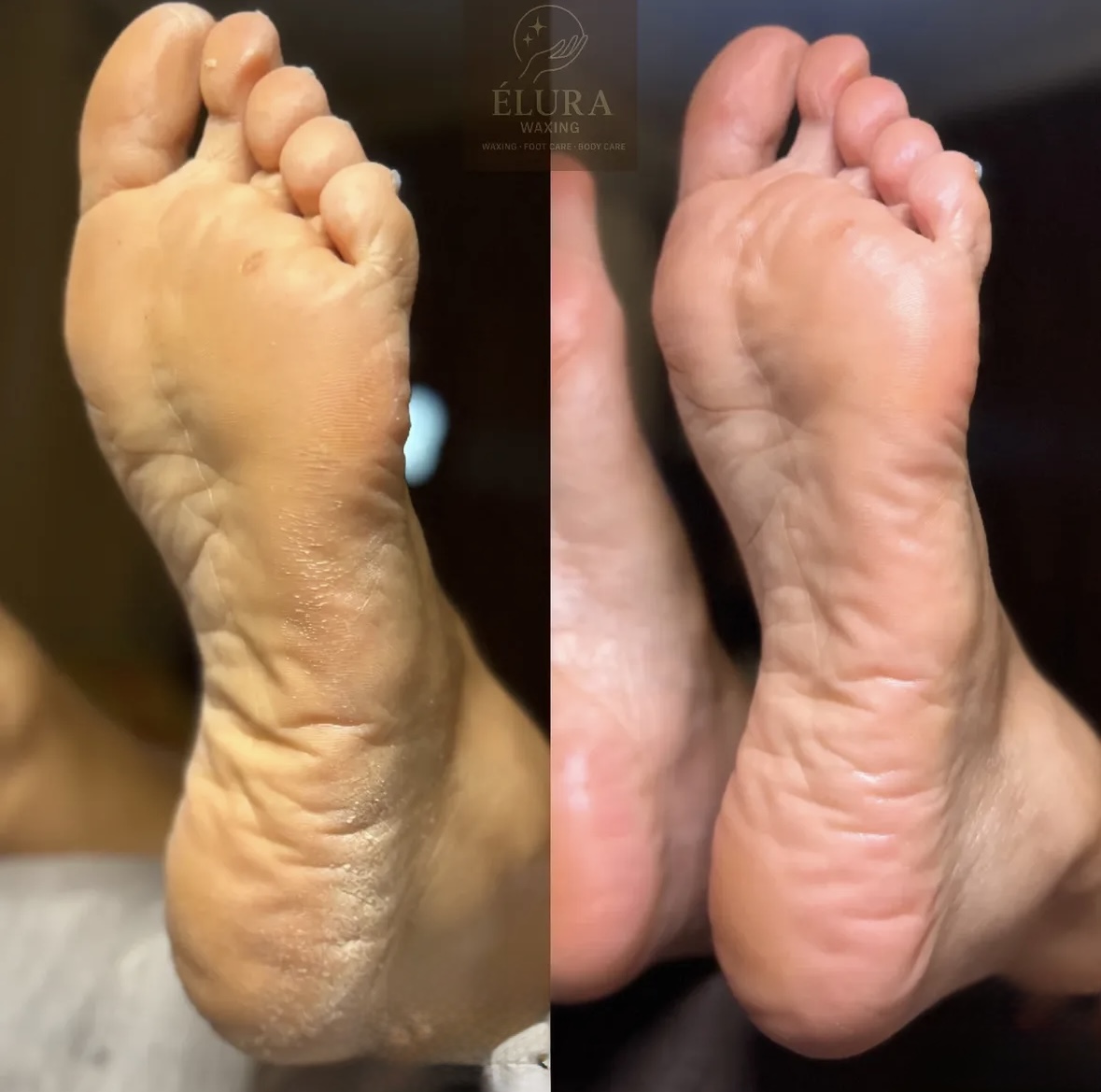 K-beauty! Waxing and foot care