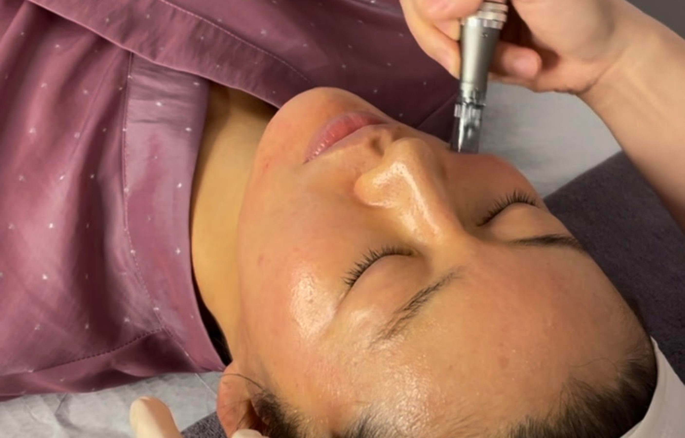 Have a customized microneedling treatment paired with a skin booster that best fits your skin concerns.