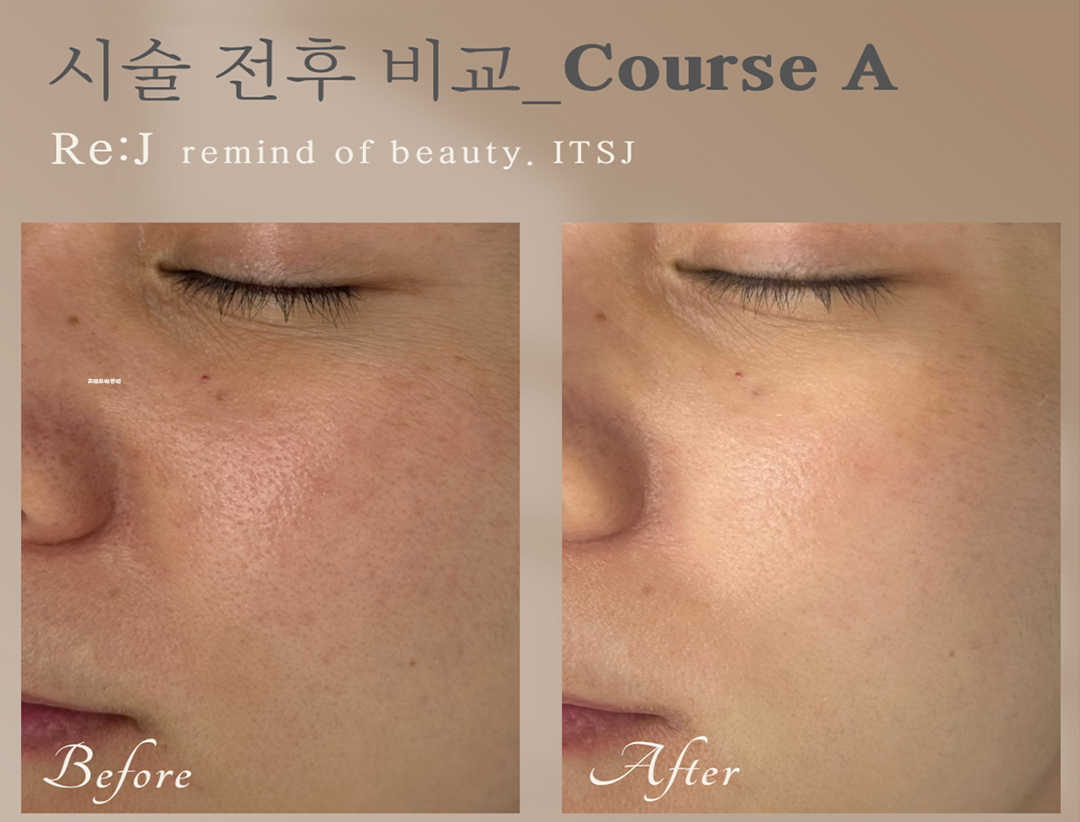 首爾江南區 Re:J高級皮膚管理專業美容院線