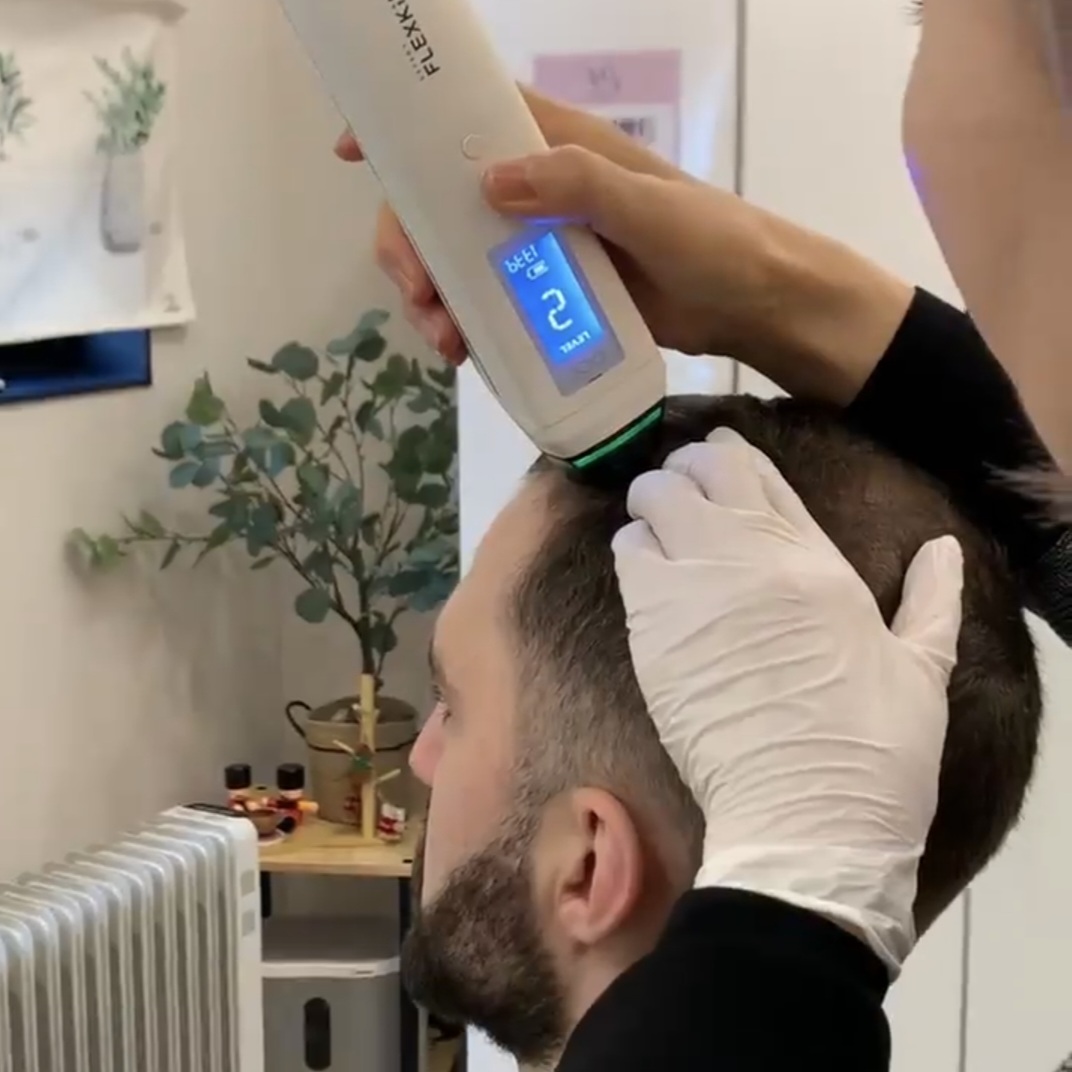 This advanced treatment combines low-level laser therapy with a stem cell ampoule to help strengthen hair roots, improve scalp condition, and support healthy hair growth. The laser stimulates circulation, while the stem cell ampoule nourishes and revitali