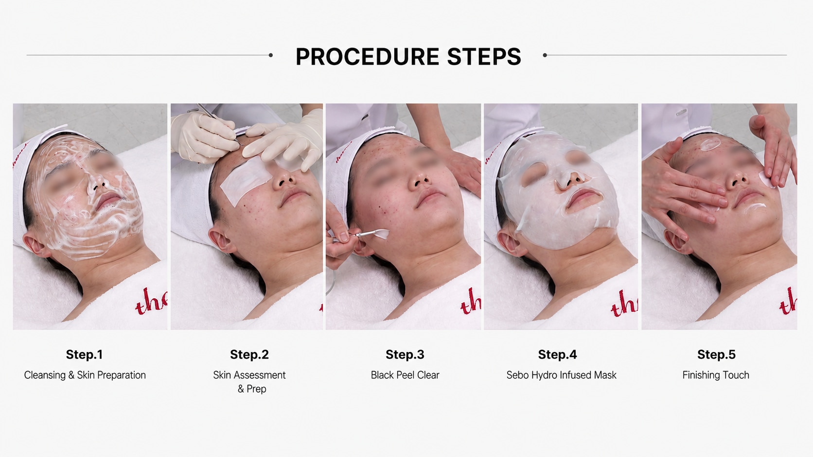 Clear Balance Peel (Black Peel)
A gentle black vinegar peel for oily, congested, and acne-prone skin. Helps control excess oil, clear pores, and improve skin texture.