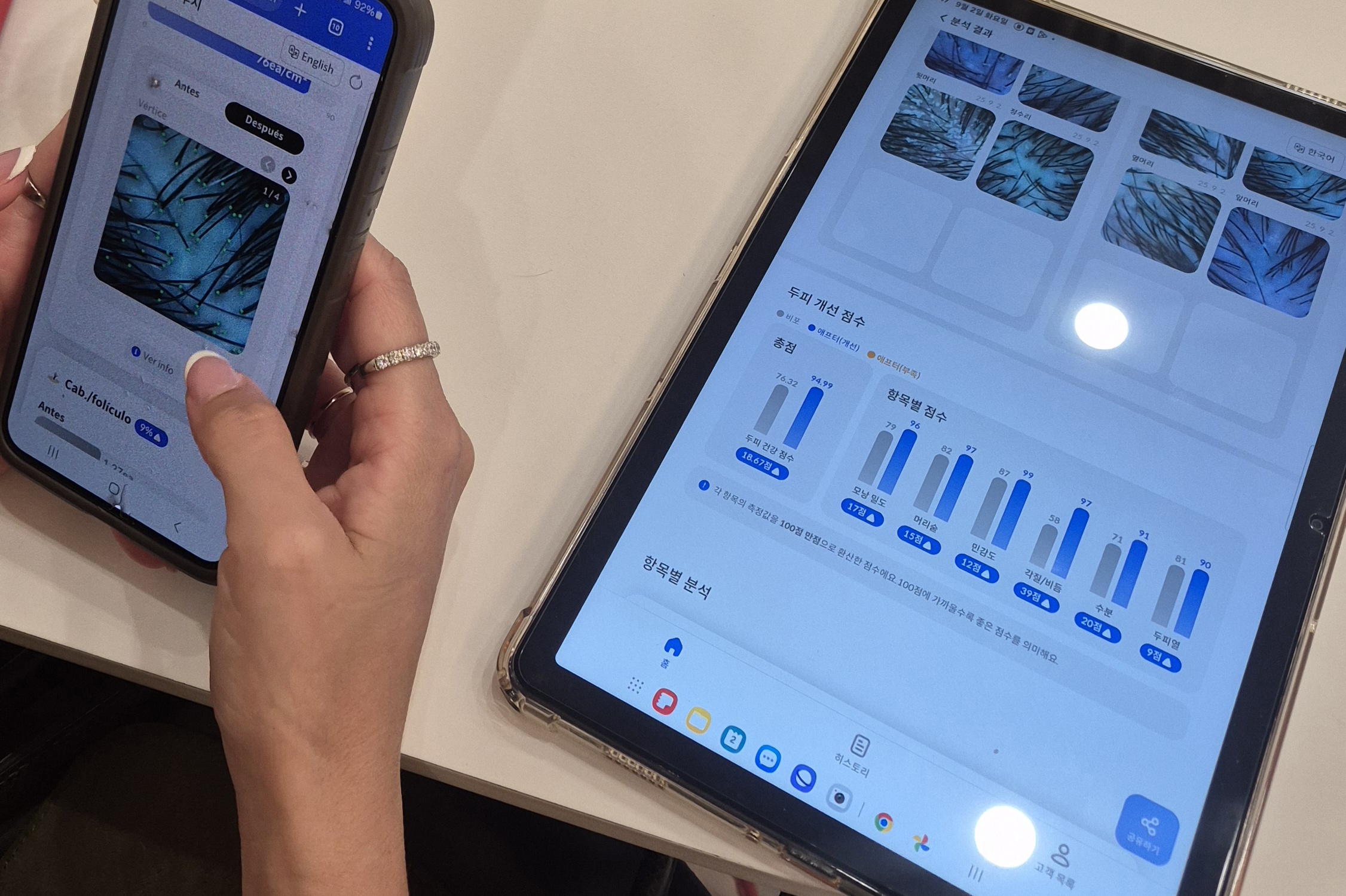 An AI scalp analysis provides a detailed diagnosis and offers 10 customized scalp care solutions tailored to individual scalp conditions.