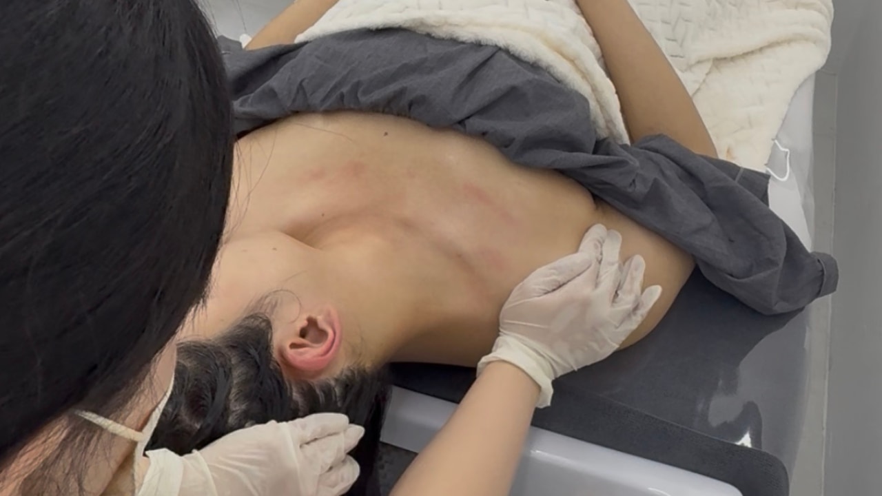 淋巴循環護理體驗 淋巴循環護理體驗