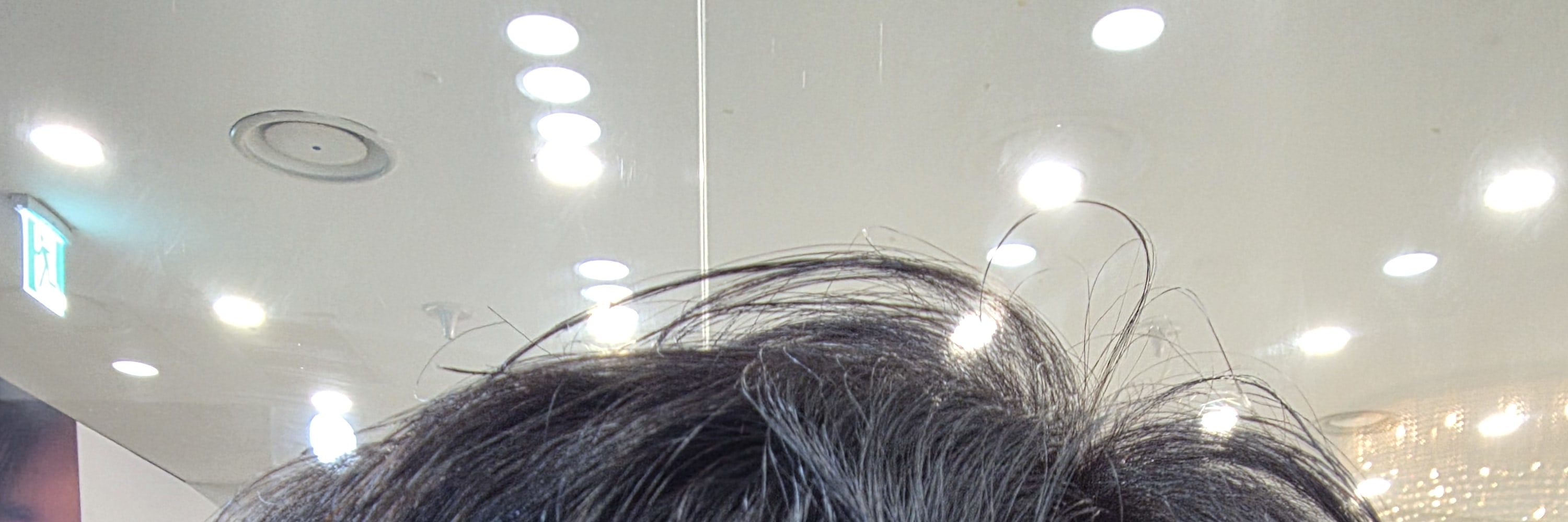 hair