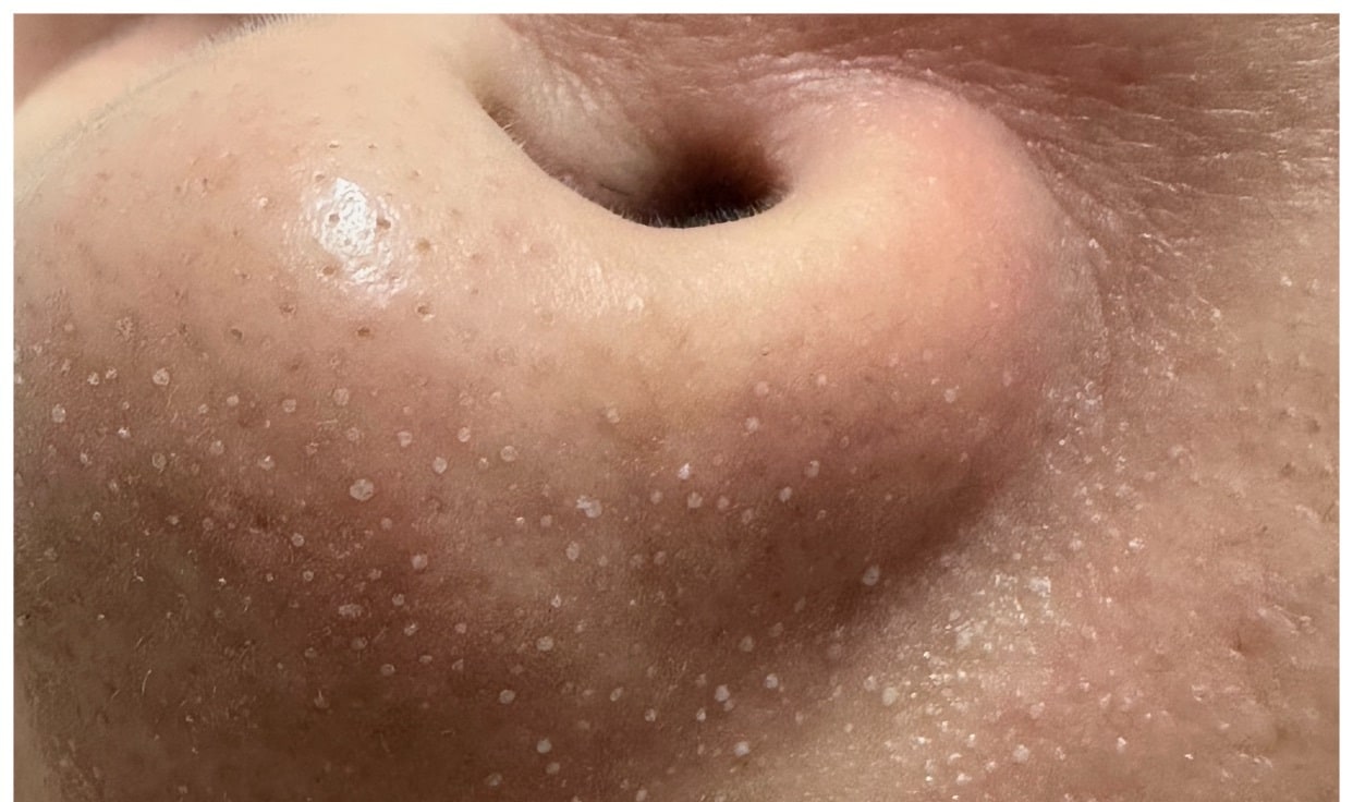 一對一細緻諮詢服務，根據個人肌膚狀態與身體狀況量身定製護理方案，過程溫和無負擔，更安心