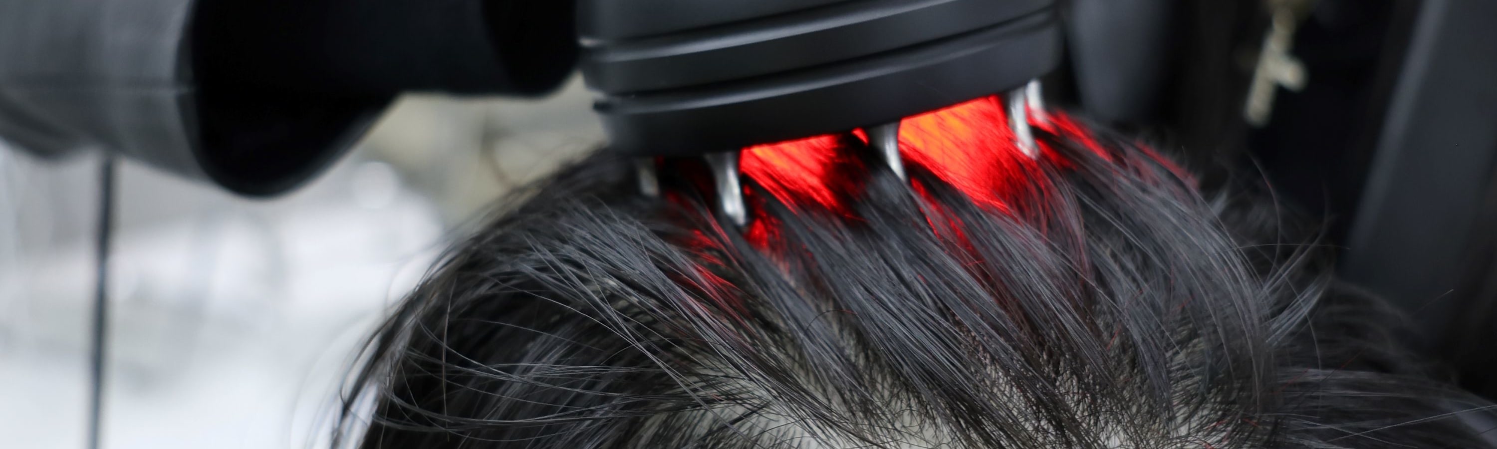 頭皮光線治療 & 頭皮細胞再生