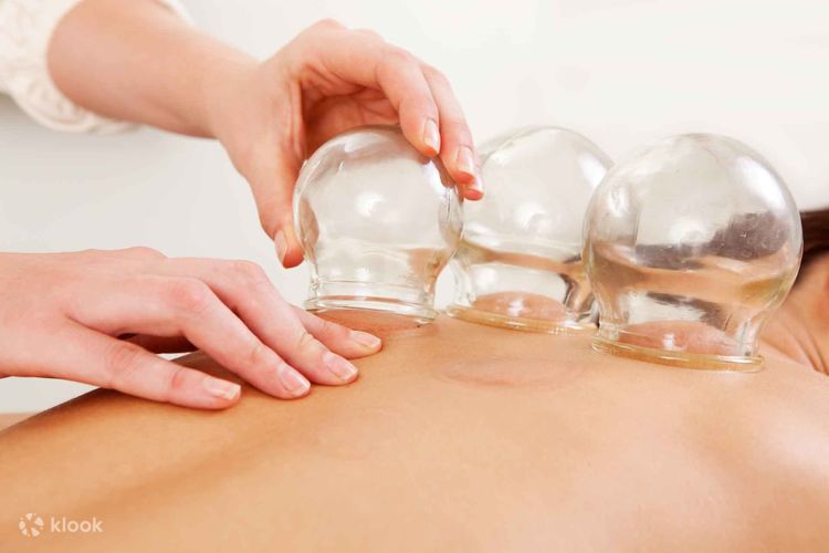 Masaje cupping top