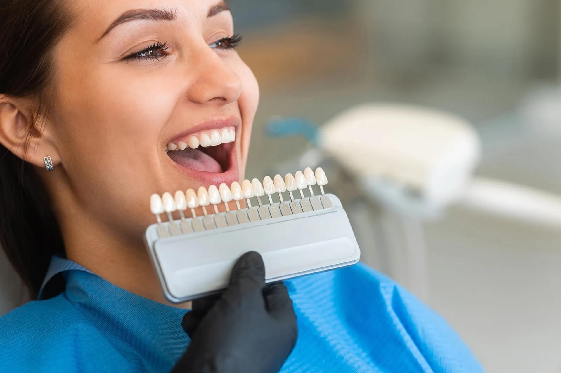 Hanoi Dental Clinic: Whitening & Cleaning Experience - Image 1