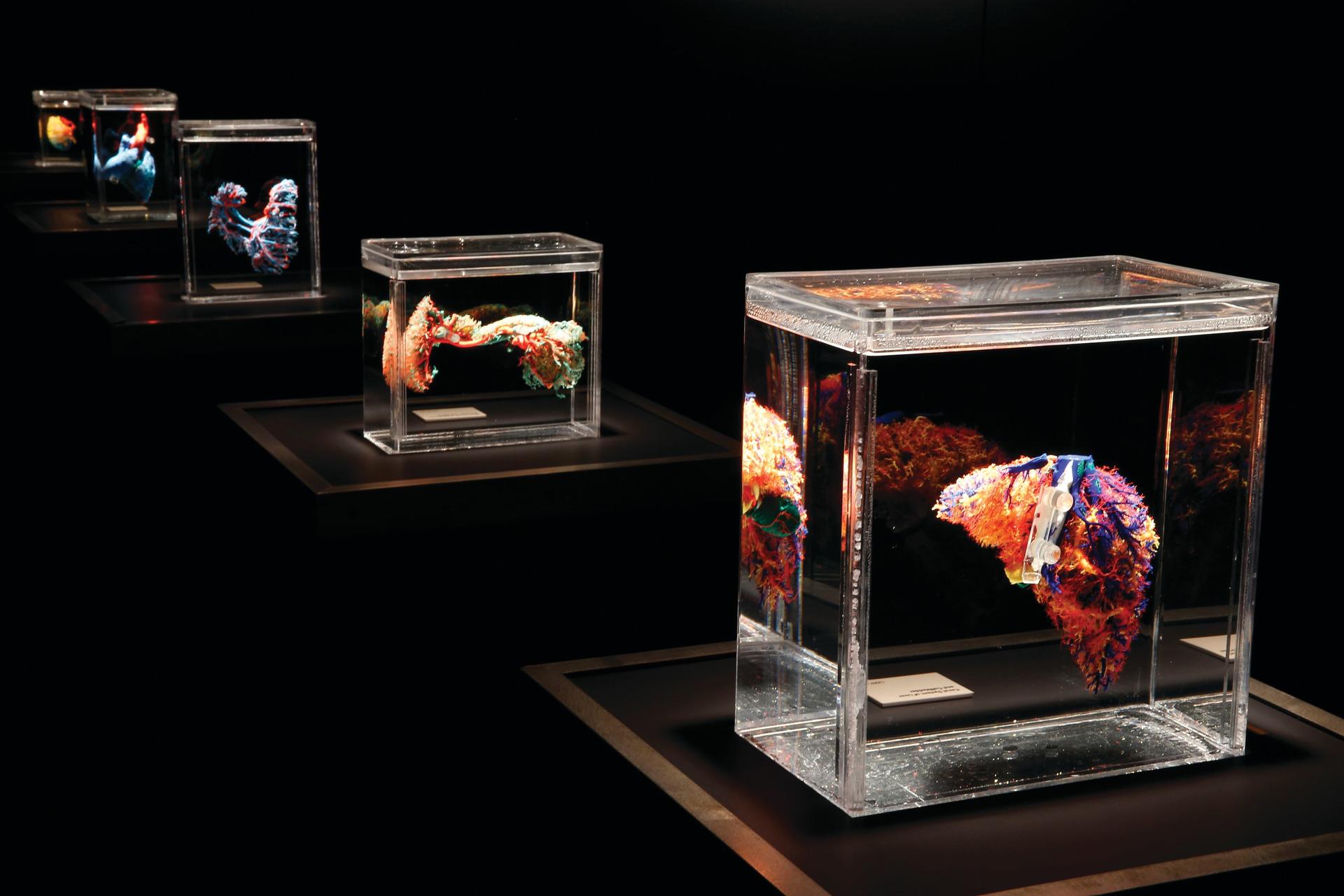 The Bodies Exhibition Ticket in Las Vegas - Thumbnail 6