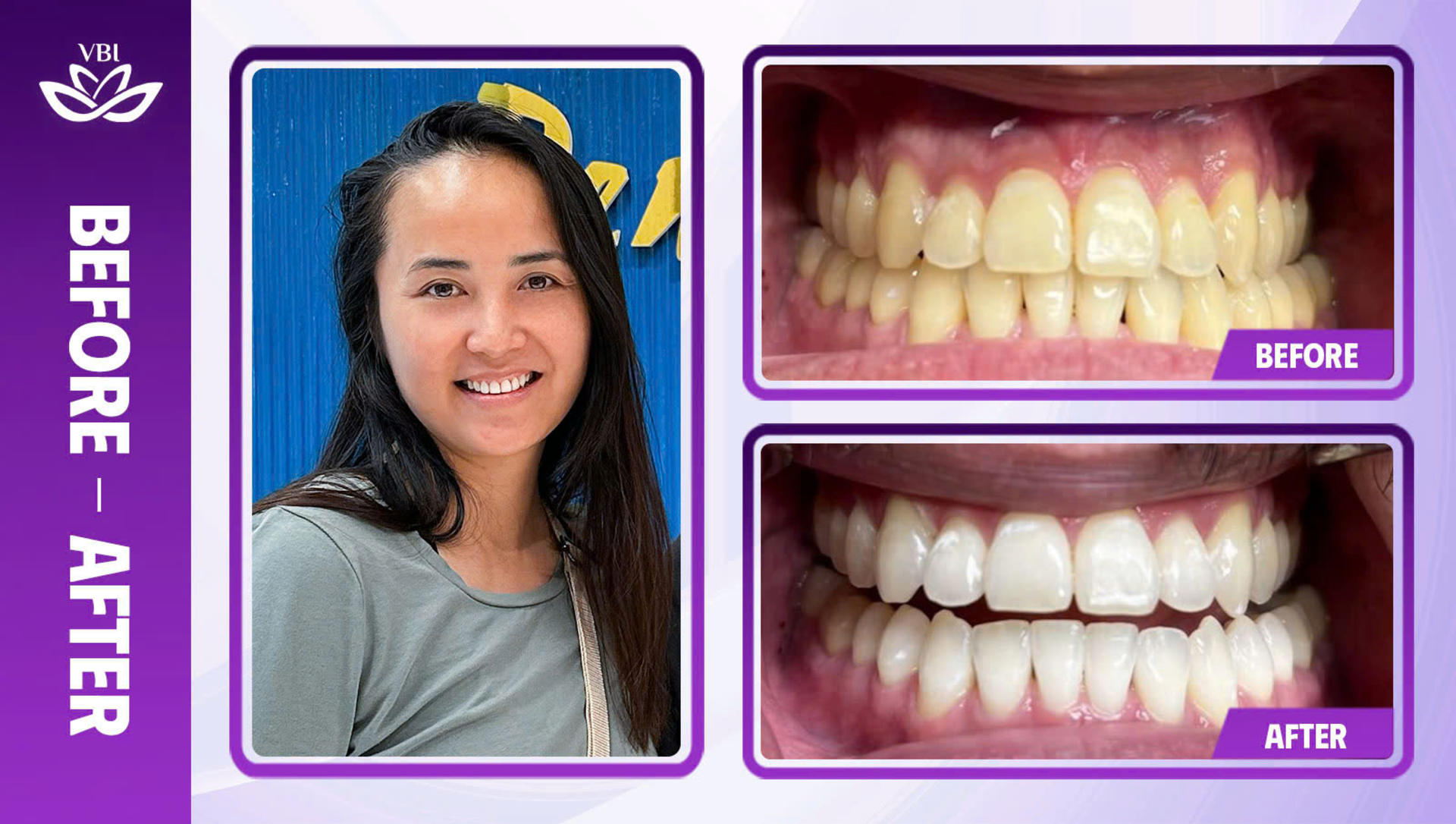 Viet Bi Premium Dental Clinic Hanoi: Professional Dental Care - Thumbnail 9