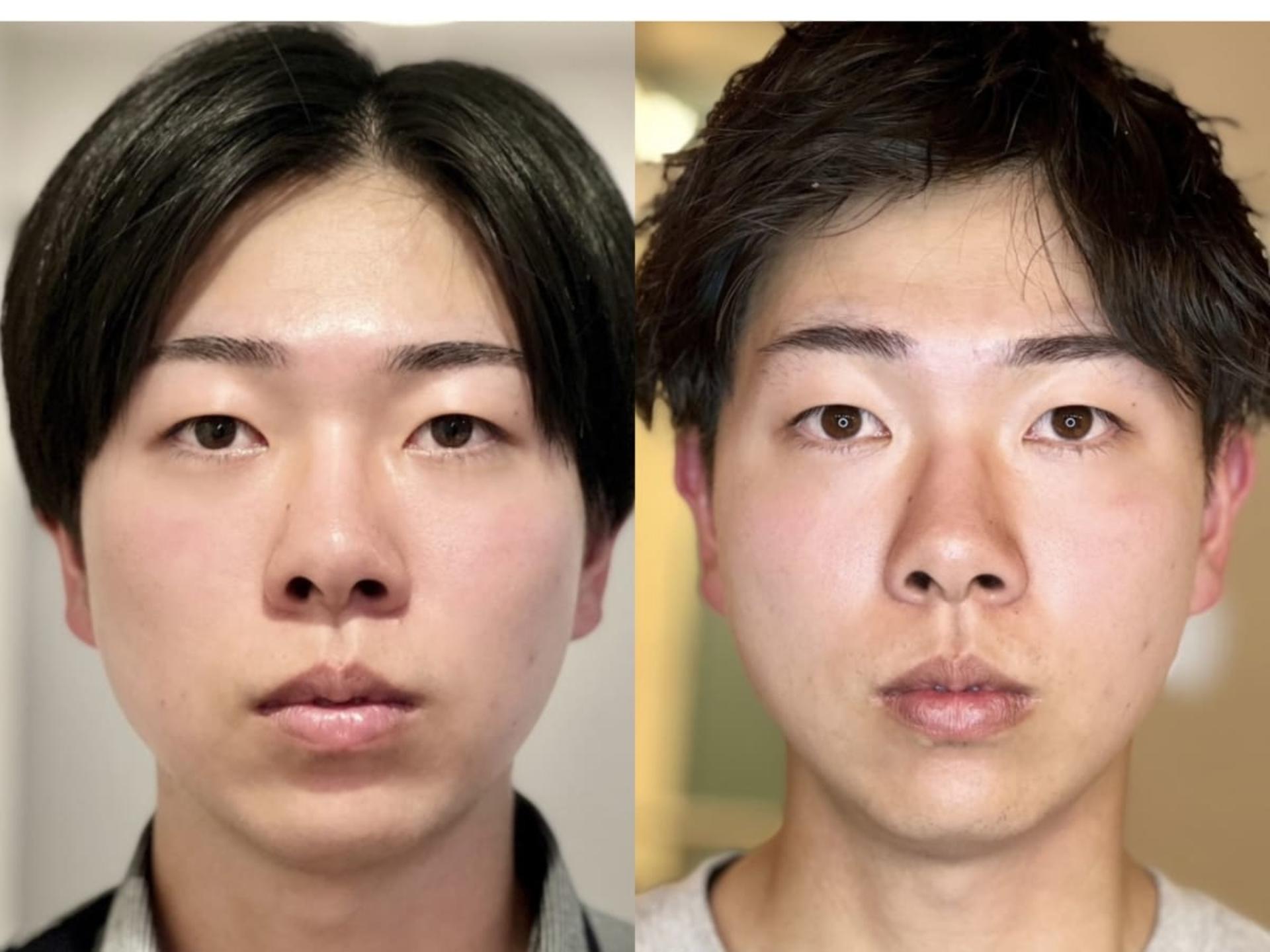 [Un Giorno Felice Omotesando Store] Massage & Deep Facial Treatments - Thumbnail 24