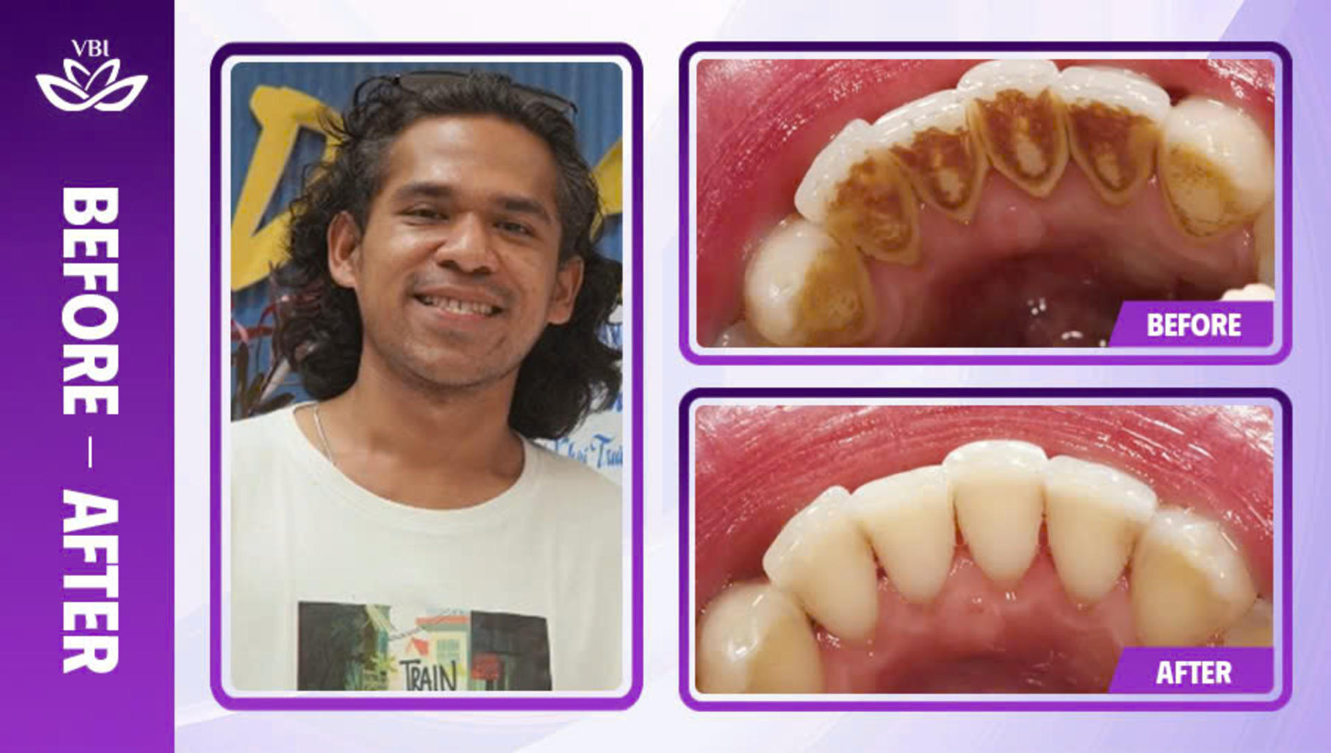 Viet Bi Premium Dental Clinic Hanoi: Professional Dental Care - Thumbnail 12