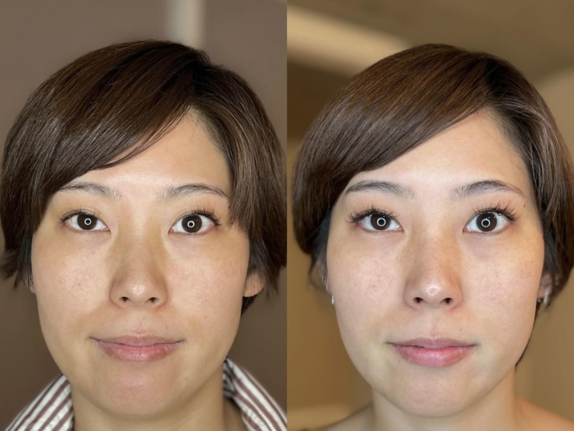 [Un Giorno Felice Omotesando Store] Massage & Deep Facial Treatments - Thumbnail 23
