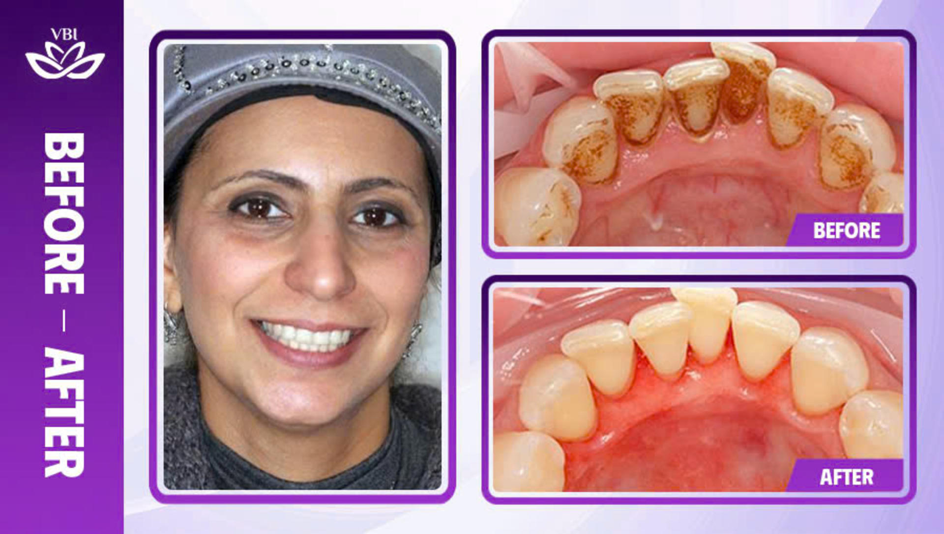 Viet Bi Premium Dental Clinic Hanoi: Professional Dental Care - Thumbnail 13