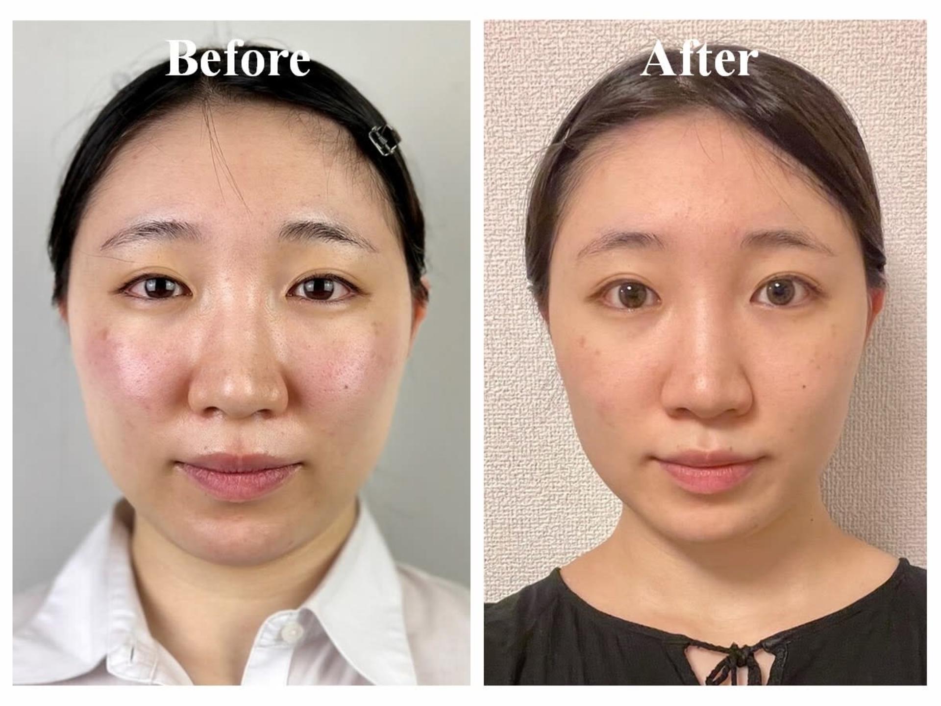[Un Giorno Felice Omotesando Store] Massage & Deep Facial Treatments - Thumbnail 26
