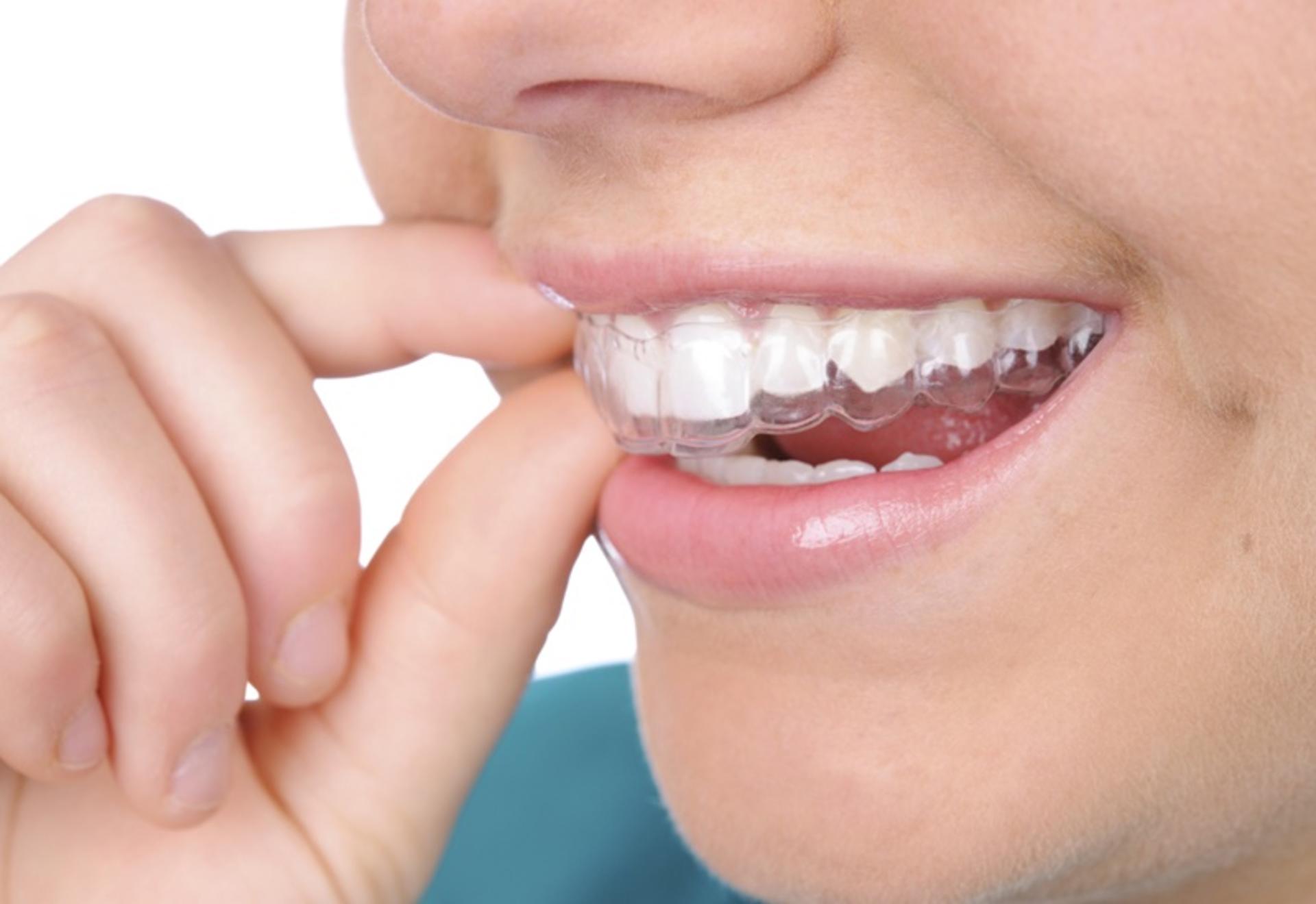 Ho Chi Minh Dental Clinic: Check Up, Whitening & Cleaning at Parkway - Thumbnail 2