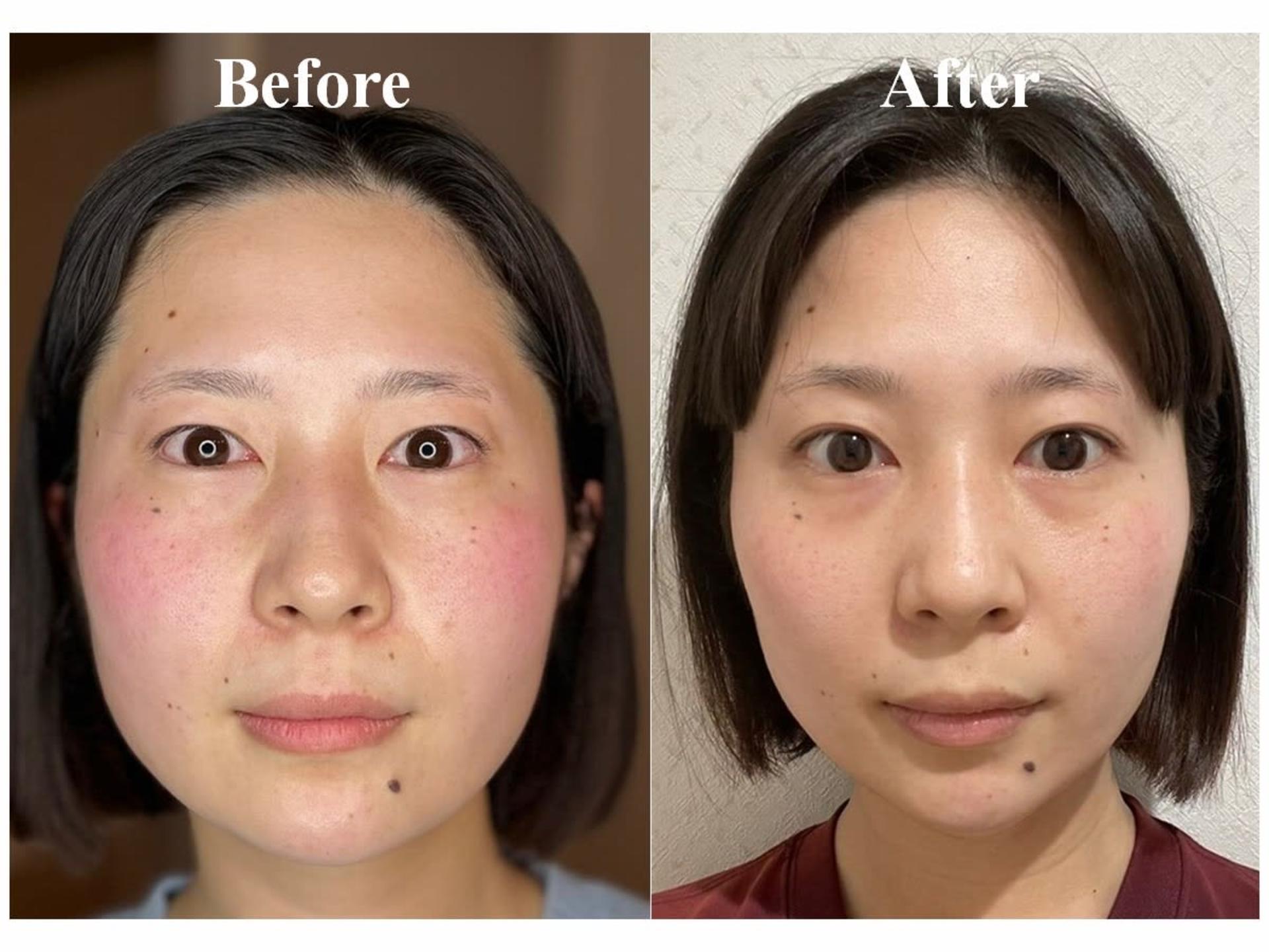 [Un Giorno Felice Omotesando Store] Massage & Deep Facial Treatments - Thumbnail 25