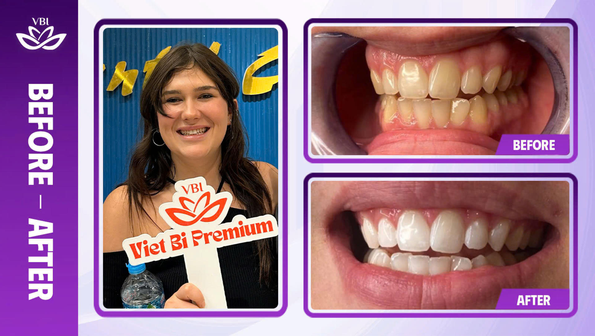 Viet Bi Premium Dental Clinic Hanoi: Professional Dental Care - Thumbnail 11