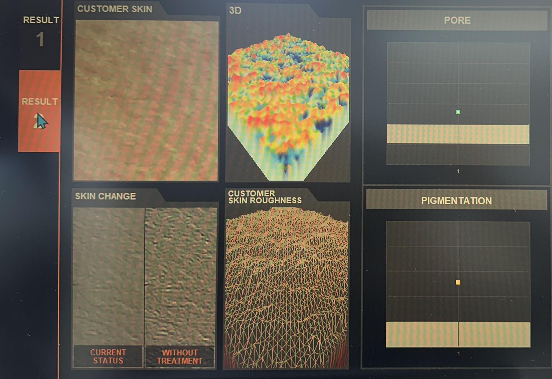 Seoul Myeongdong 3D Skin Age and Hair Scan with 1:1 Expert Consult - Thumbnail 5