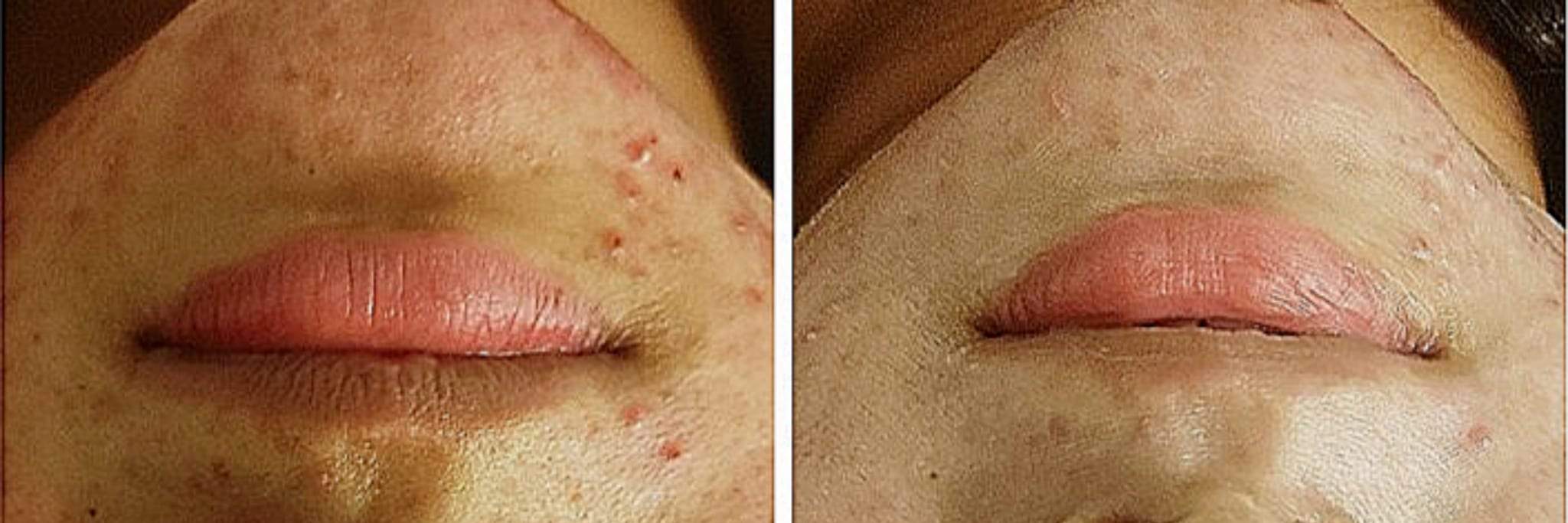 一次体验，肌肤焕然一新。