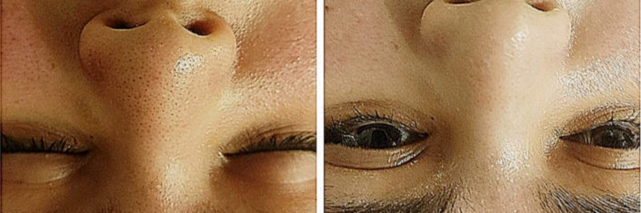 一次体验，肌肤焕然一新。