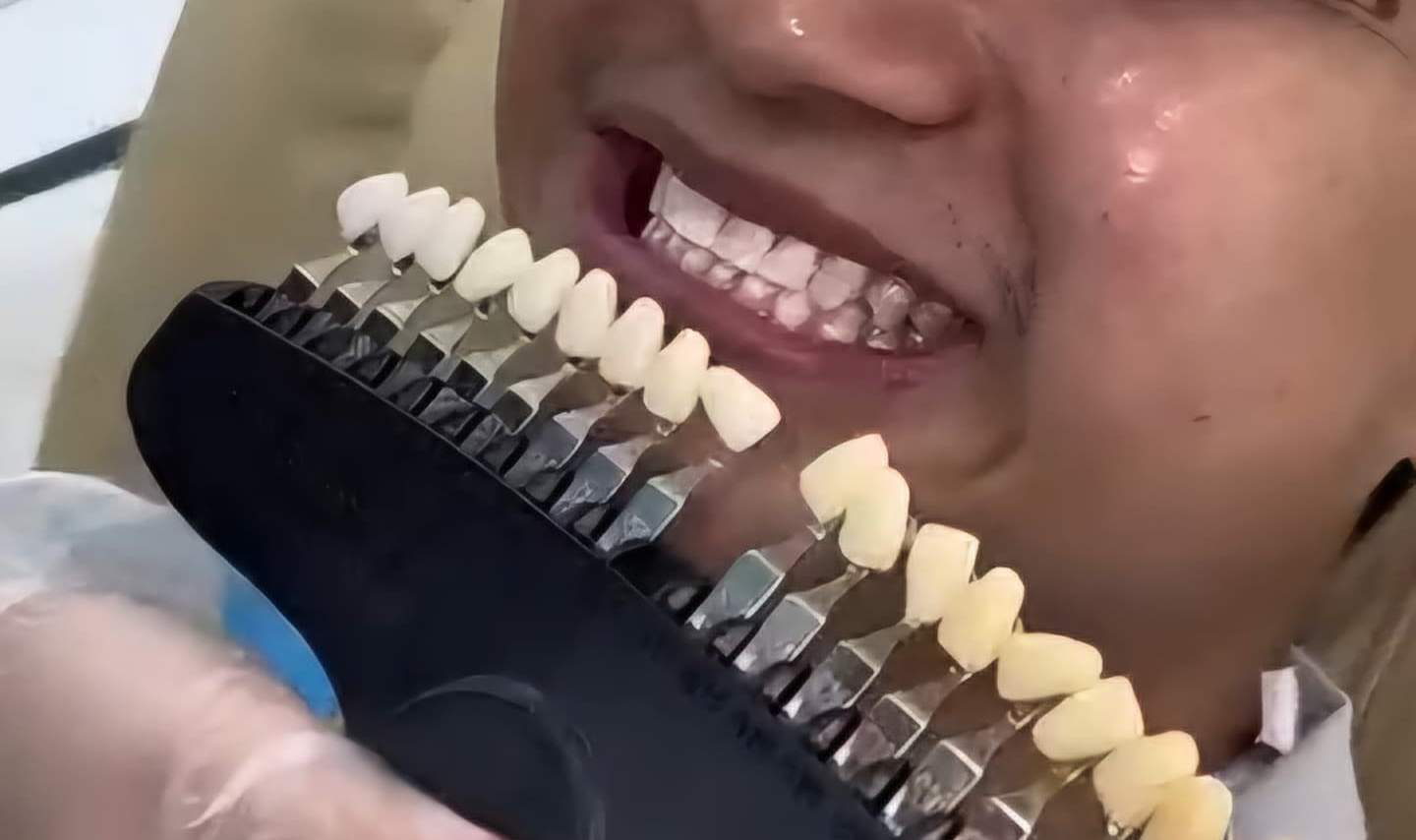 Vorher-Nachher-Enthüllung: Sehen Sie sich diesen Unterschied an!