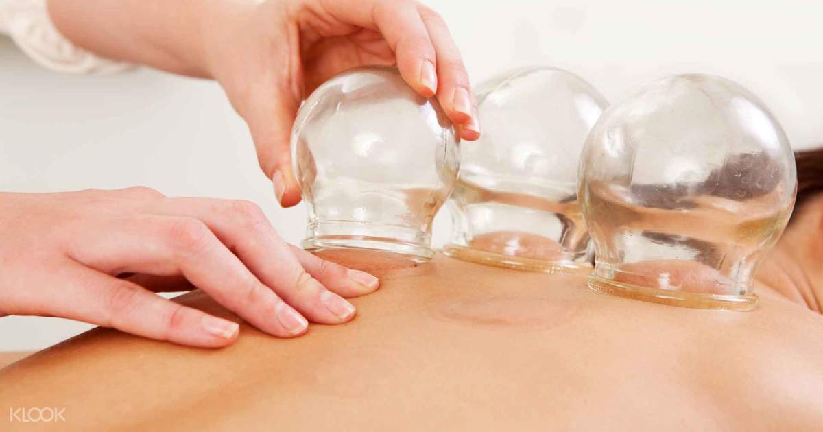 Cupping therapy price near me