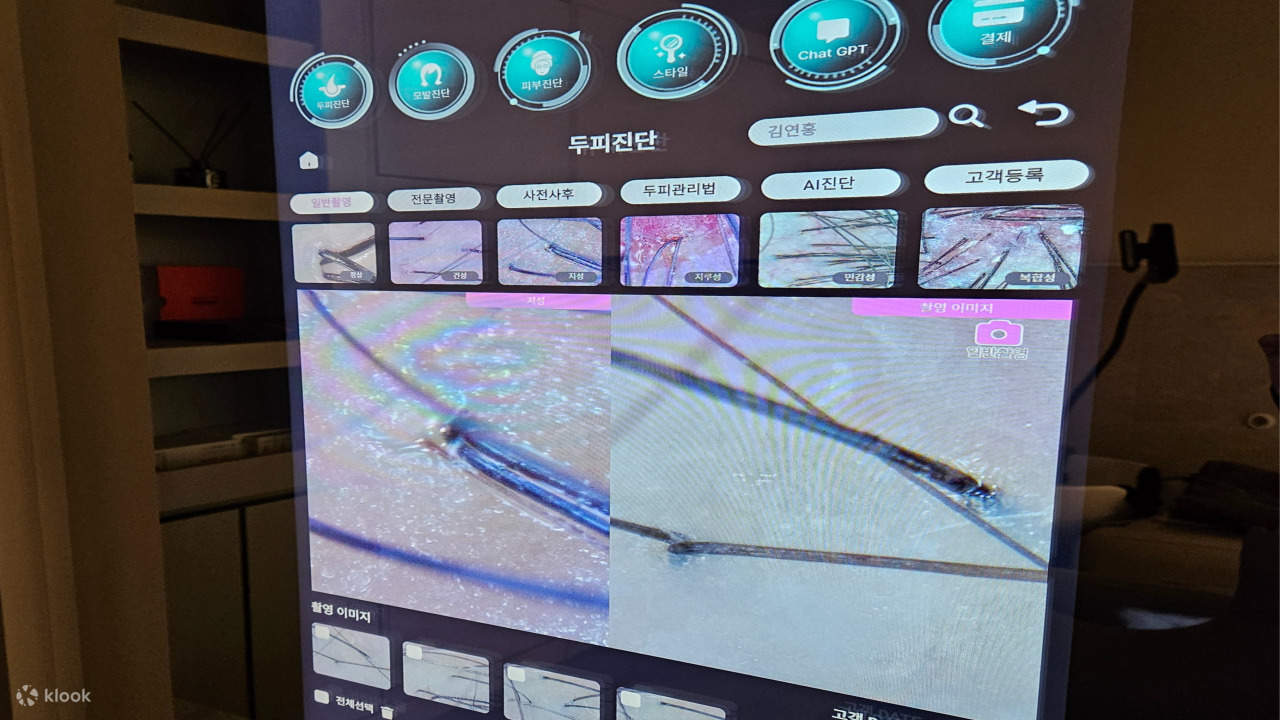 หลังจากถ่ายภาพหนังศีรษะด้วยกล้องจุลทรรศน์อิเล็กตรอนแล้ว กระจกอัจฉริยะ AI จะทำการวินิจฉัยสภาพหนังศีรษะของคุณ