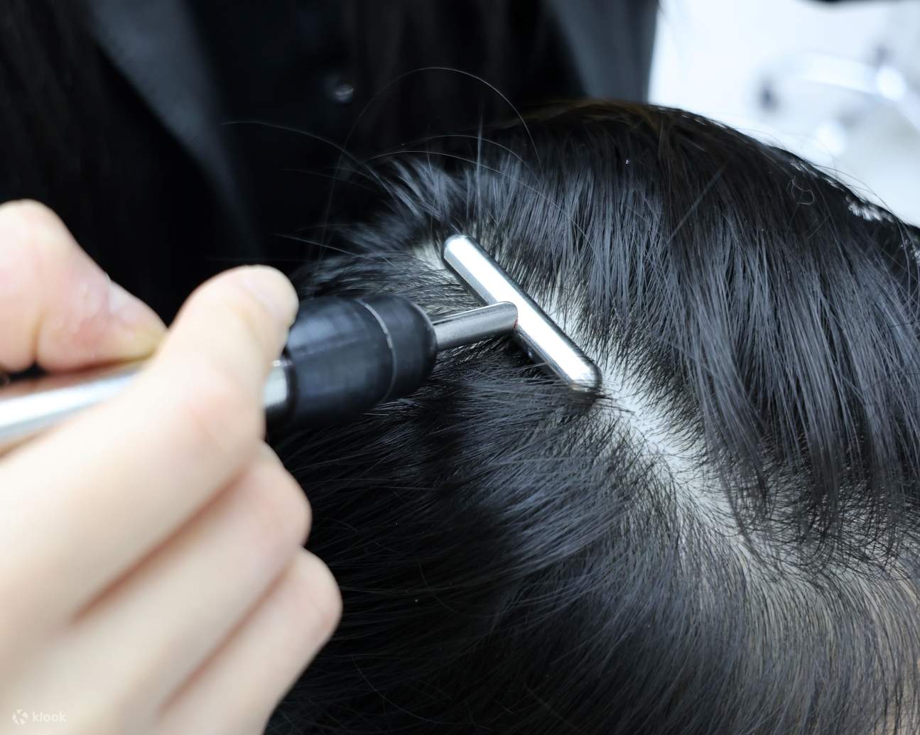 두피 재생 트리트먼트 주입