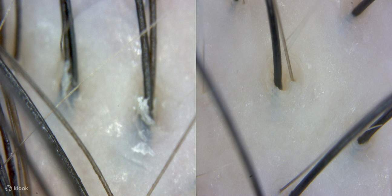 ก่อนและหลัง