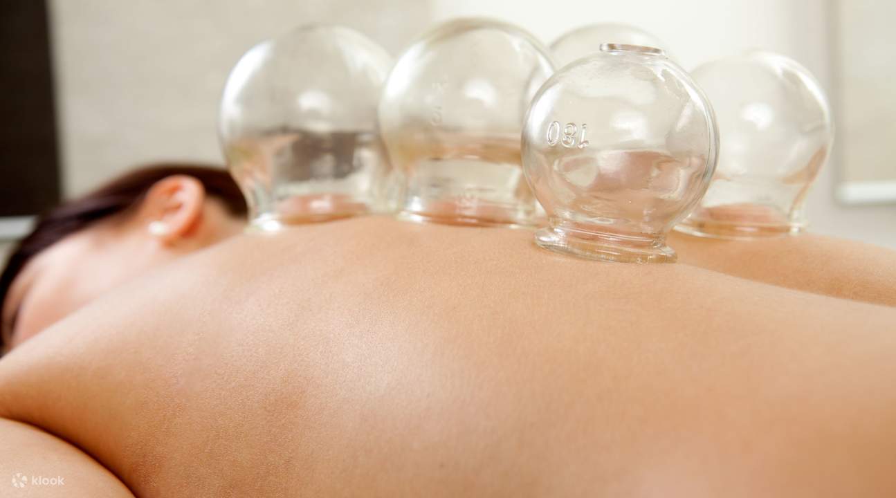 cupping chinese medicine