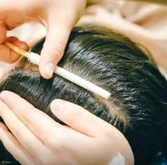 Centre de traitement premium du cuir chevelu et de la perte de cheveux à Moklock Gangnam