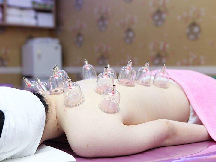 CUPPING